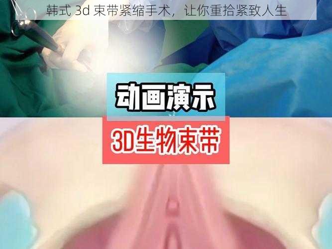 韩式 3d 束带紧缩手术，让你重拾紧致人生